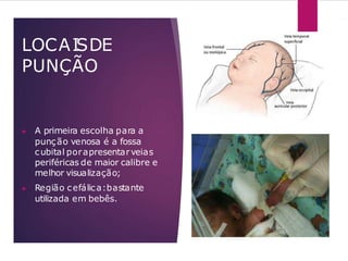 LOCAISDE
PUNÇÃO
▶ A primeira escolha para a
punção venosa é a fossa
cubital porapresentarveias
periféricas de maior calibre e
melhor visualização;
▶ Região cefálica:bastante
utilizada em bebês.
 
