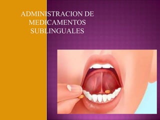 ADMINISTRACION DE
MEDICAMENTOS
SUBLINGUALES

 