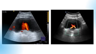 Comprehensive Diagnostic Ultrasound of Urinary Tract and Bladder ...