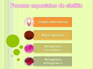 Cistitis Intersticial

Malacoplaquia
Metaplasia
escamosa
Metaplasia
nefrogenica

 