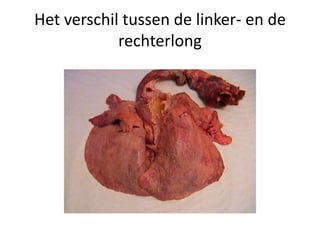 Het verschil tussen de linker- en de
rechterlong
 