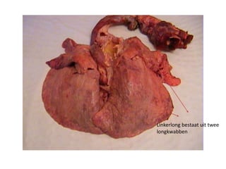 Linkerlong bestaat uit twee
longkwabben
 
