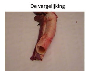 De vergelijking
 