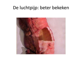 De luchtpijp: beter bekeken
 