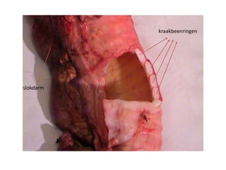 kraakbeenringen
slokdarm
 