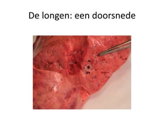 De longen: een doorsnede
 