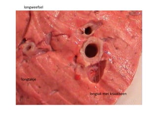 longtak met kraakbeen
longweefsel
longtakje
 