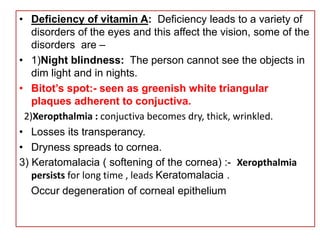 • Deficiency of vitamin A: Deficiency leads to a variety of
disorders of the eyes and this affect the vision, some of the
disorders are –
• 1)Night blindness: The person cannot see the objects in
dim light and in nights.
• Bitot’s spot:- seen as greenish white triangular
plaques adherent to conjuctiva.
2)Xeropthalmia : conjuctiva becomes dry, thick, wrinkled.
• Losses its transperancy.
• Dryness spreads to cornea.
3) Keratomalacia ( softening of the cornea) :- Xeropthalmia
persists for long time , leads Keratomalacia .
Occur degeneration of corneal epithelium
 