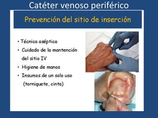 Catéter venoso periférico
 