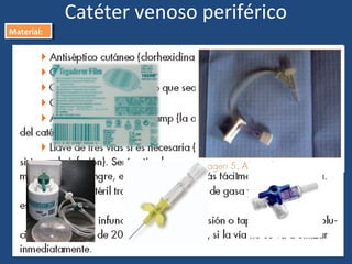 Catéter venoso periférico
Material:
Material:
 