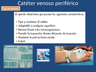 Catéter venoso periférico
Tipo de Apósito:
Tipo de Apósito:
 