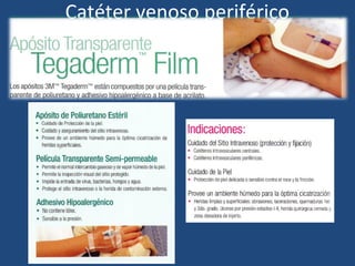 Catéter venoso periférico
 