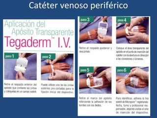 Catéter venoso periférico
 