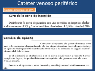 Catéter venoso periférico
Cuidados Enfermeros en CVP:
Cuidados Enfermeros en CVP:
 