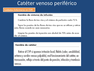 Catéter venoso periférico
Cuidados Enfermeros en CVP:
Cuidados Enfermeros en CVP:
 