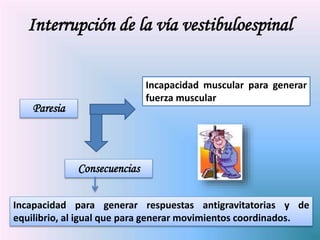 Paresia
Incapacidad muscular para generar
fuerza muscular
Consecuencias
Incapacidad para generar respuestas antigravitatorias y de
equilibrio, al igual que para generar movimientos coordinados.
Interrupción de la vía vestibuloespinal
 