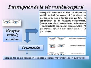 Nistagmus
vertical y
estrabismo
Nistagmus movimientos rápido de los ojos en
sentido vertical. (nervio óptico) El estrabismo es
desviación de uno o los dos ojos por falta de
coordinación de los músculos oculomotores.
(nervios que afecta: nervio motor ocular común
– oculomotor III par craneal, nervio patético - IV
par craneal, nervio motor ocular externo – VI
par craneal).
Consecuencias
Incapacidad para orientación la cabeza y realizar movimientos con guía visual.
Interrupción de la vía vestibuloespinal
 
