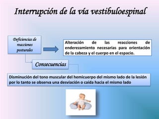 Disminución del tono muscular del hemicuerpo del mismo lado de la lesión
por lo tanto se observa una desviación o caída hacia el mismo lado
Deficiencias de
reacciones
posturales
Alteración de las reacciones de
enderezamiento necesarias para orientación
de la cabeza y el cuerpo en el espacio.
Consecuencias
Interrupción de la vía vestibuloespinal
 