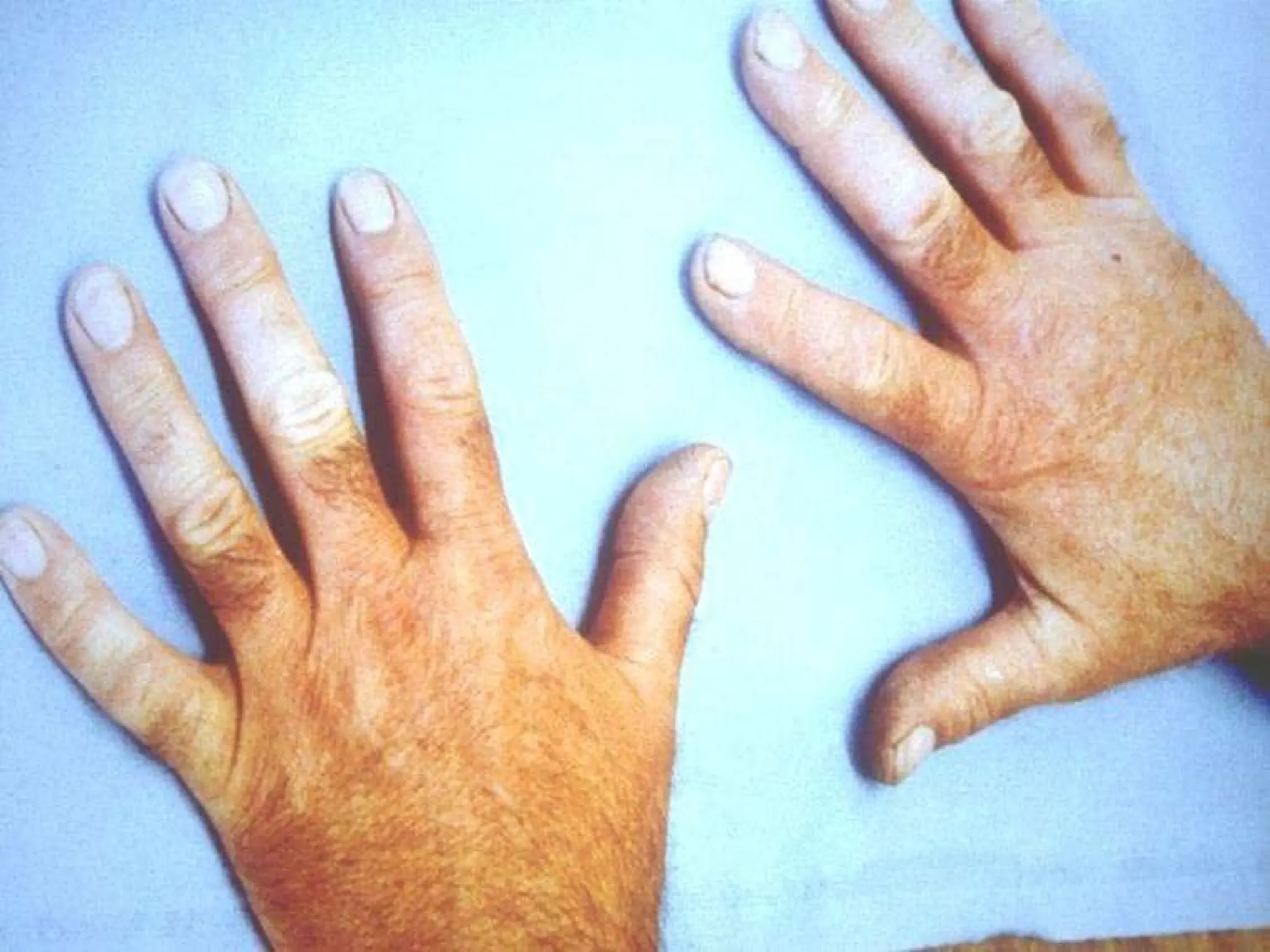 Consultnet Limited © 14
 