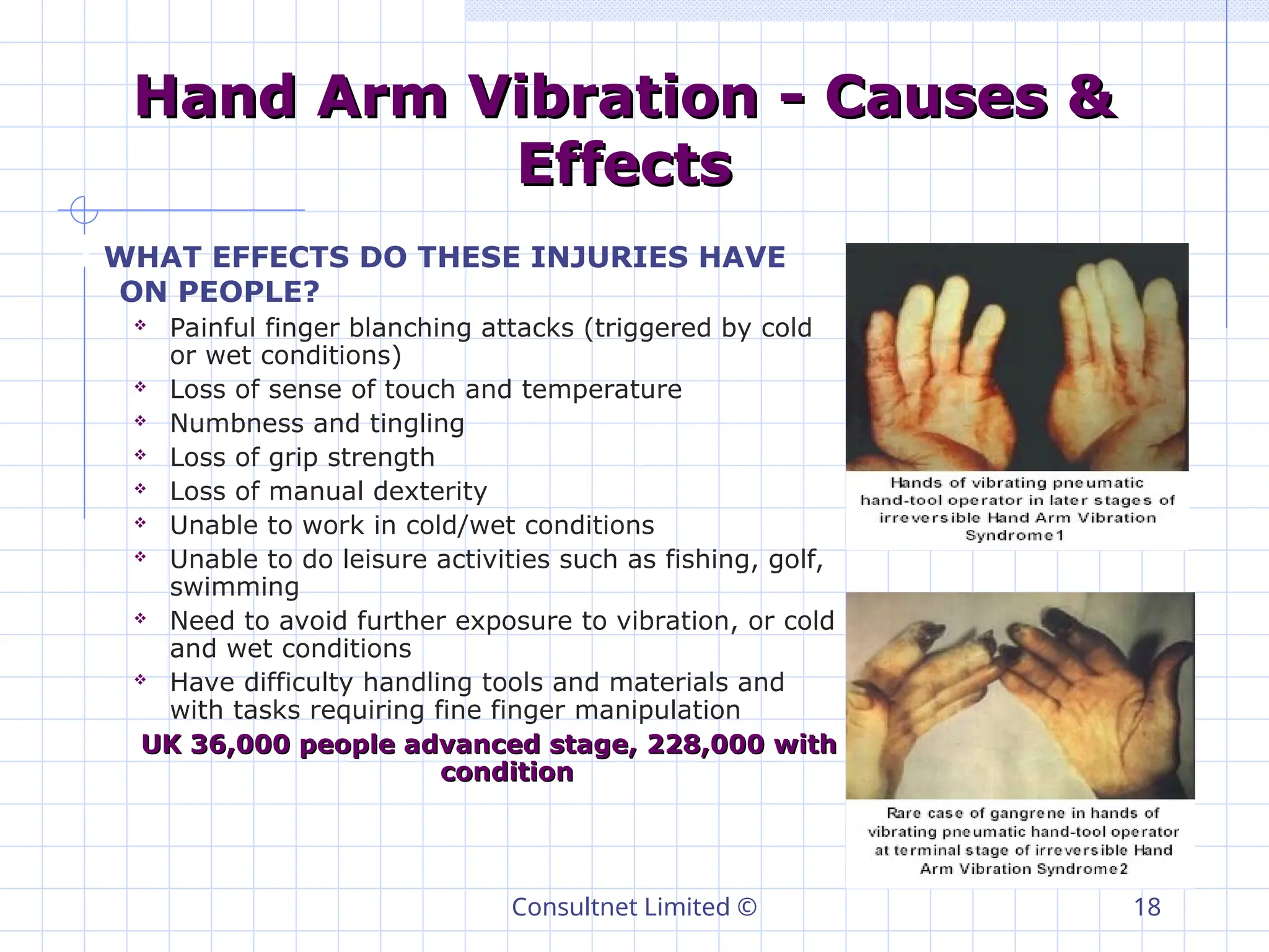 Consultnet Limited © 18
Hand Arm Vibration - Causes &
Hand Arm Vibration - Causes &
Effects
Effects
) WHAT EFFECTS DO THESE INJURIES HAVE
ON PEOPLE?
 Painful finger blanching attacks (triggered by cold
or wet conditions)
 Loss of sense of touch and temperature
 Numbness and tingling
 Loss of grip strength
 Loss of manual dexterity
 Unable to work in cold/wet conditions
 Unable to do leisure activities such as fishing, golf,
swimming
 Need to avoid further exposure to vibration, or cold
and wet conditions
 Have difficulty handling tools and materials and
with tasks requiring fine finger manipulation
UK 36,000 people advanced stage, 228,000 with
UK 36,000 people advanced stage, 228,000 with
condition
condition
 
