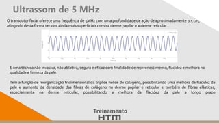 Ultrassom de 5 MHz
O transdutor facial oferece uma frequência de 5MHz com uma profundidade de ação de aproximadamente 0,5 cm,
atingindo desta forma tecidos ainda mais superficiais como a derme papilar e a derme reticular.
É uma técnica não invasiva, não ablativa, segura e eficaz com finalidade de rejuvenescimento, flacidez e melhora na
qualidade e firmeza da pele.
Tem a função de reorganização tridimensional da tríplice hélice de colágeno, possibilitando uma melhora da flacidez da
pele e aumento da densidade das fibras de colágeno na derme papilar e reticular e também de fibras elásticas,
especialmente na derme reticular, possibilitando a melhora da flacidez da pele a longo prazo
 