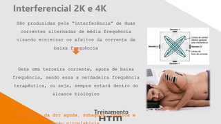 Interferencial 2K e 4K
São produzidas pela “interferência” de duas
correntes alternadas de média frequência
visando minimizar os efeitos da corrente de
baixa frequência
Gera uma terceira corrente, agora de baixa
frequência, sendo essa a verdadeira frequência
terapêutica, ou seja, sempre estará dentro do
alcance biológico
Analgesia da dor aguda, subaguda, crônica e
 