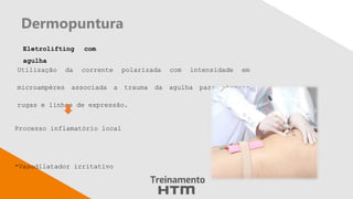 Dermopuntura
Eletrolifting com
agulha
Utilização da corrente polarizada com intensidade em
microampères associada a trauma da agulha para atenuar
rugas e linhas de expressão.
Processo inflamatório local
*Vasodilatador irritativo
 