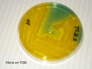 Vibrio en TCBS
 