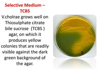 Selective Medium –
TCBS
V.cholrae grows well on
Thiosulphate citrate
bile sucrose (TCBS )
agar, on which it
produces yellow
colonies that are readily
visible against the dark
green background of
the agar.
 