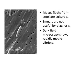 • Mucus flecks from
stool are cultured.
• Smears are not
useful for diagnosis.
• Dark field
microscopy shows
rapidly motile
vibrio's.
 