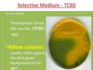 Vibrio cholerae | PPTX