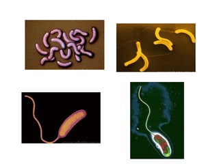 Vibrio cholera bacteriology advanced.ppt
