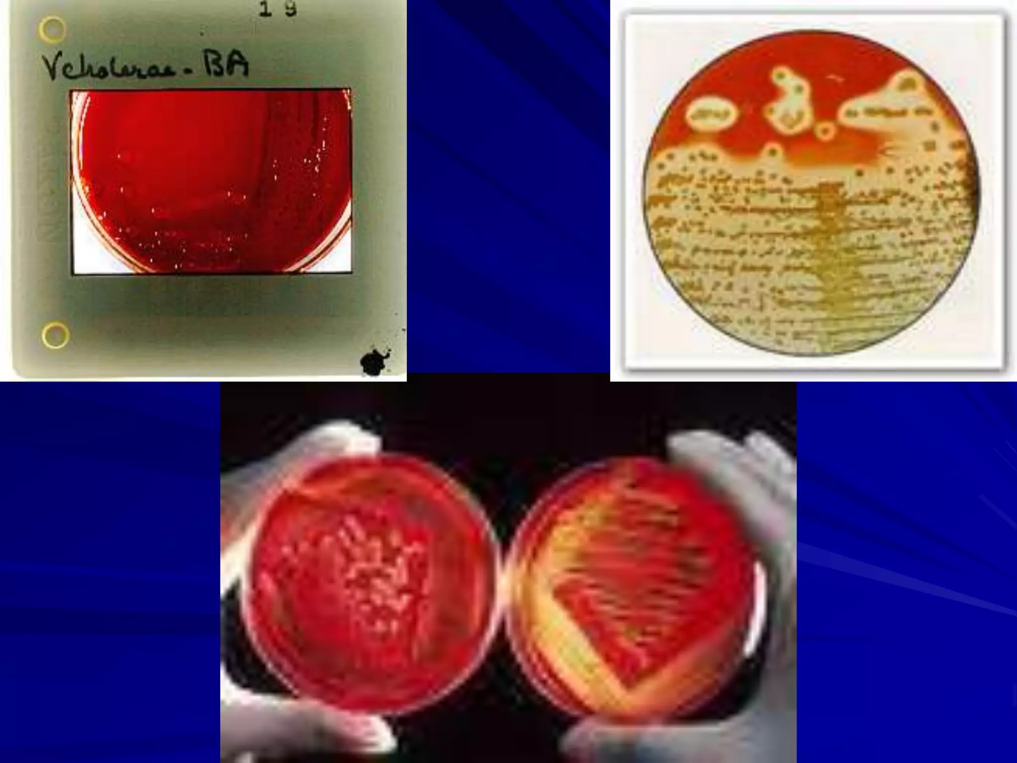 Vibrio cholera and Halophilic vibrio.ppt