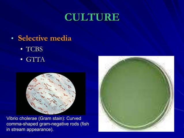 Vibrio cholera and Halophilic vibrio.ppt