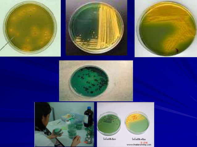 Vibrio cholera and Halophilic vibrio.ppt