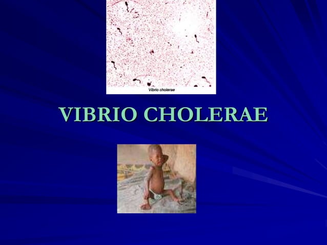 Vibrio cholera and Halophilic vibrio.ppt