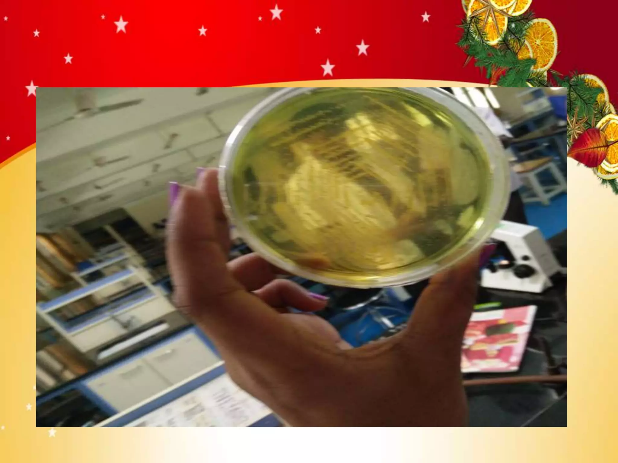 Vibrio cholerae PPT for students | PPTX