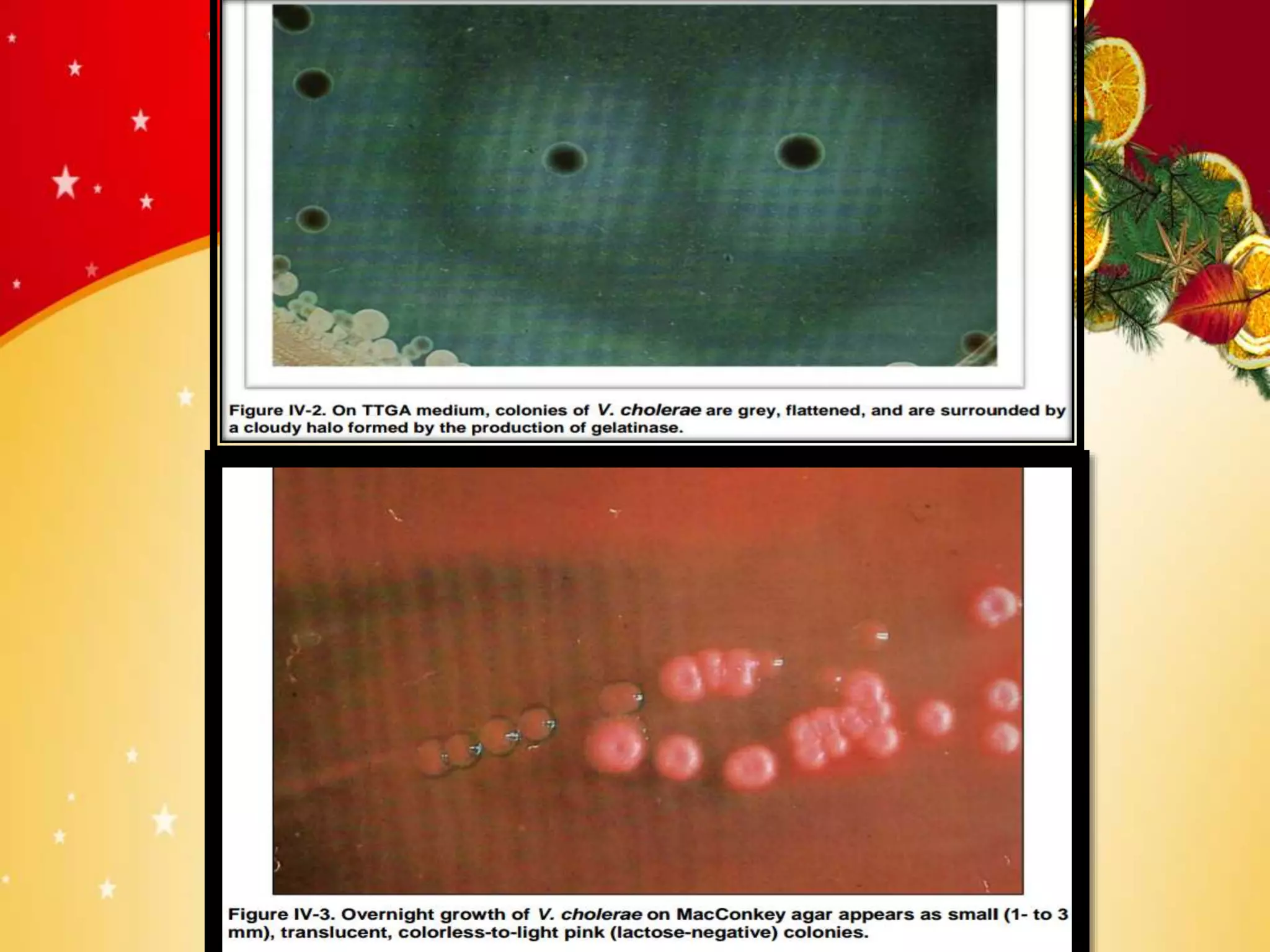 Vibrio cholerae PPT for students | PPTX