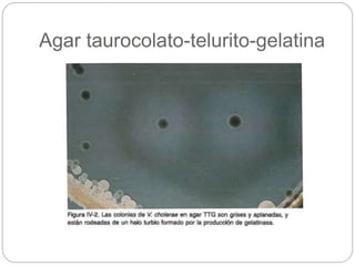 Agar taurocolato-telurito-gelatina
 