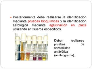  Posteriormente debe realizarse la identificación
mediante pruebas bioquímicas y la identificación
serológica mediante aglutinación en placa
utilizando antisueros específicos.
Deben realizarse
pruebas de
sensibilidad
antibiótica
(antibiograma).
 