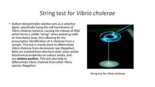 String Bacteria Overview of Vibrio cholerae.........pptx