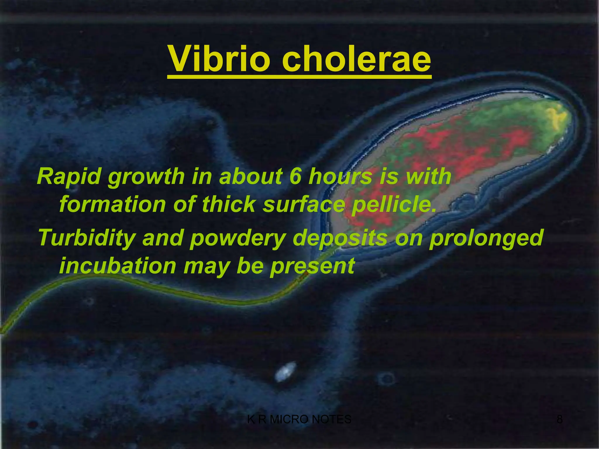 Vibrio Cholera Ppt