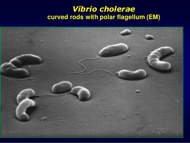 vibrio cholerae ppt Ppt vibrio cholerae powerpoint presentation id:3012746.