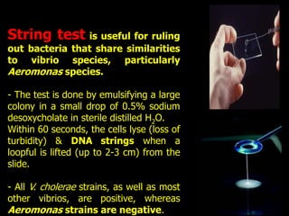 String Bacteria Vibrio & other related organisms dr. ihsan alsaimary lec 10 | PPT