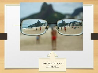 VISION DE LEJOS
ALTERADA
 