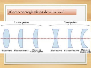 ¿Cómo corregir vicios de refracción?
 