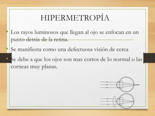 HIPERMETROPÍA
• Los rayos luminosos que llegan al ojo se enfocan en un
punto detrás de la retina.
• Se manifiesta como una defectuosa visión de cerca
• Se debe a que los ojos son mas cortos de lo normal o las
corneas muy planas.
 
