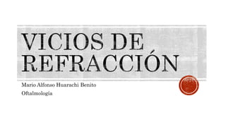 Mario Alfonso Huarachi Benito
Oftalmología
 