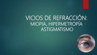 VICIOS DE REFRACCIÓN:
MIOPIA, HIPERMETROPÍA
ASTIGMATISMO
 