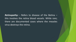 Prevention: - There is no specific anti-viral treatment for
measles making vaccination the best means of limiting the
spre...